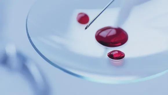 Một, hai giọt máu có thể xét nghiệm đủ thứ bệnh trên đời?