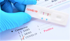 Lâm Đồng: Giá xét nghiệm COVID-19 tại cơ sở y tế tư nhân theo quy định nào?
