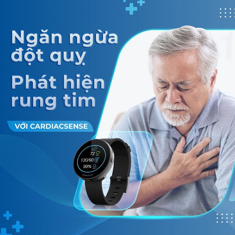 Ngăn ngừa đột quỵ, phát hiện rung tim với CardiaCsense